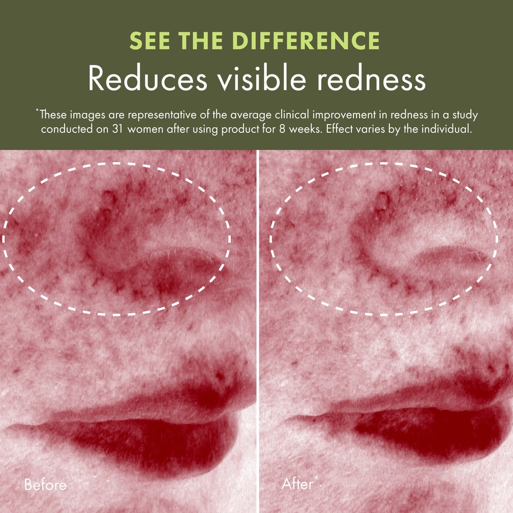 Sérum concentré protecteur de la barrière cutanée Mega-Mushroom Dr. Andrew Weil for Origins™, 30 ml